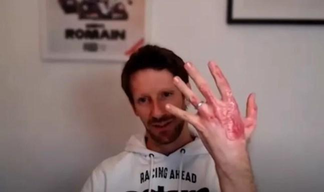 Romain Grosjean mostra mão recuperada após 1 ano do acidente na Fórmula 1 — Foto: Reprodução