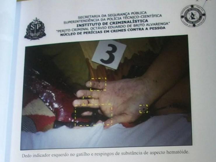 Foto da perícia mostra mão esquerda de Marcelo perto de arma.  (Foto: Reprodução)