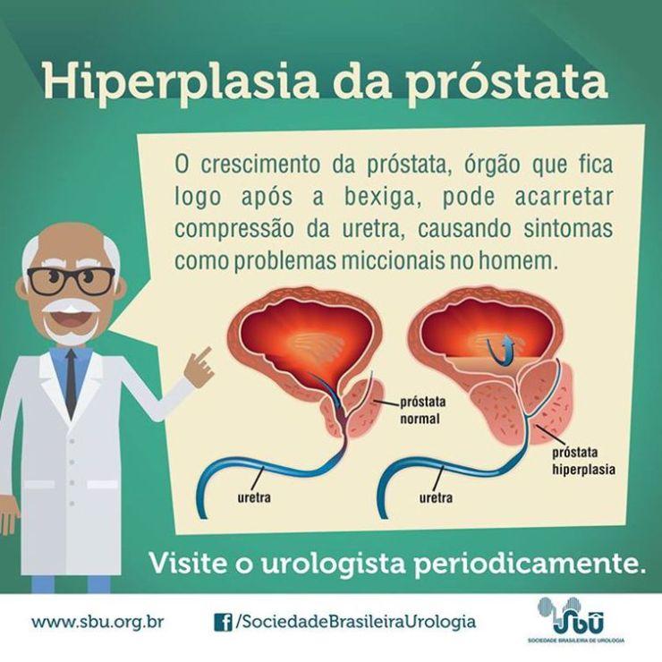  Divulgação/Sociedade Brasileira de Urologia