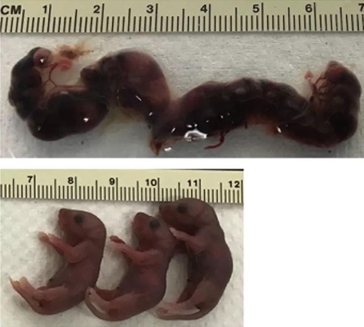 Fetos de fêmeas de camundongos que receberam vacinas experimentais contra zika (embaixo) são comparados a fetos de fêmeas que não foram imunizadas (em cima). Todas as fêmeas foram expostas ao vírus  (Foto: Cell/Divulgação)