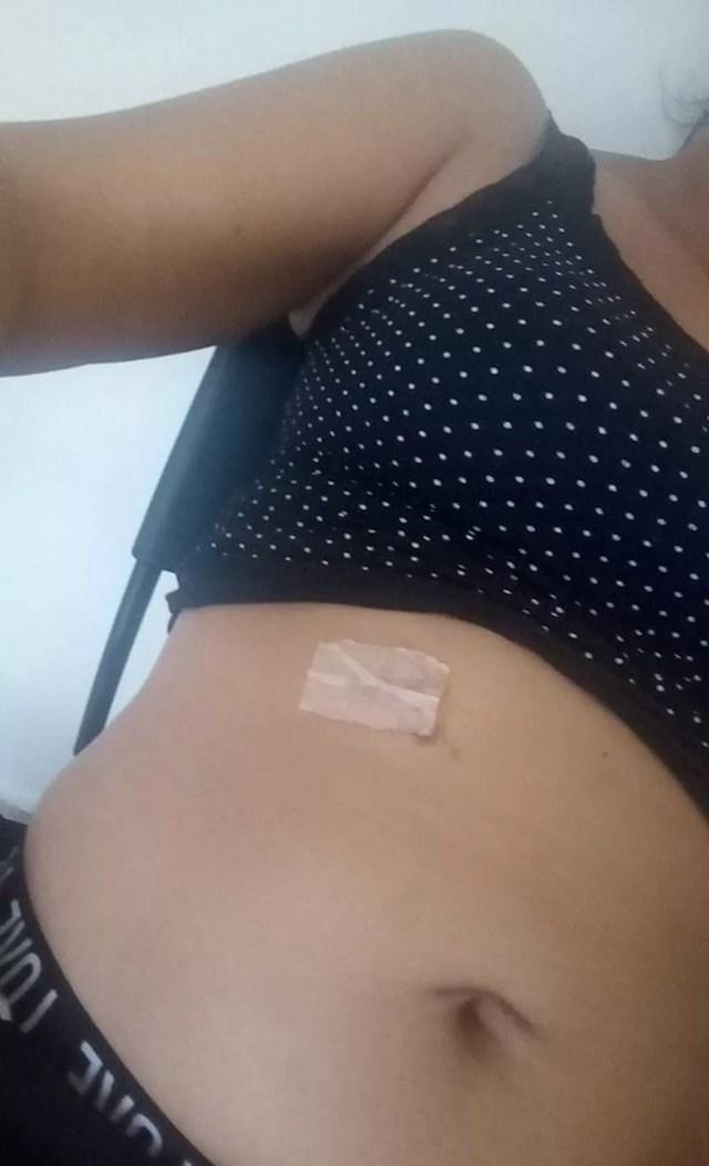 Mulher diz ter sido atingida por arma de choque ao reclamar de falta de médicos — Foto: Célia Ramos/Arquivo Pessoal