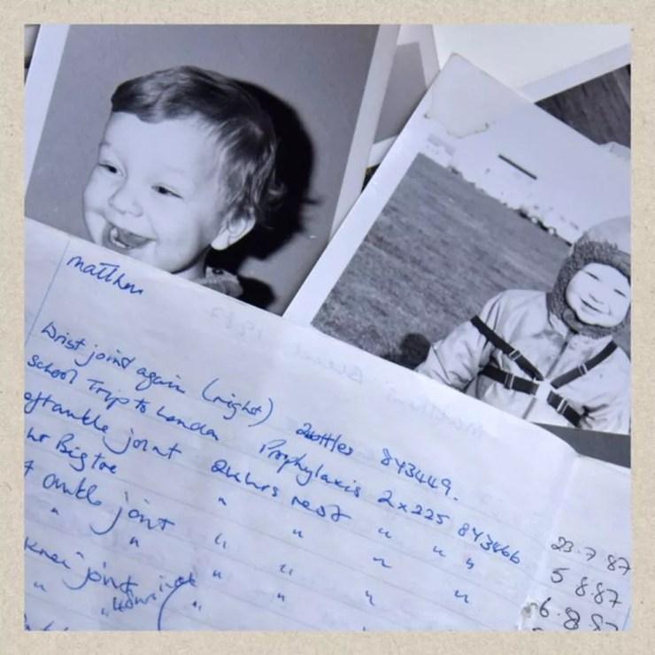 A hemofilia, que levou Matt ao tratamento por meio do qual foi contaminado, provocou limitações durante a infância (Foto: Arquivo Pessoal/BBC)
