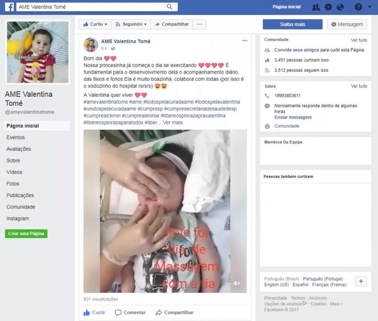 Família criou página em rede social para buscar ajuda financeira, Piracicaba (Foto: Reprodução/Facebook/AME Valentina Tomé)