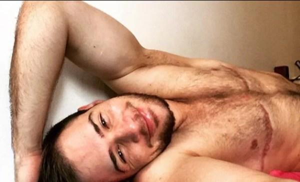 Paulo posa sem camisa em posts nas suas redes sociais. Na foto, ele exibe as cicatrizes da cirurgia de retirada de mamas (Foto: Reprodução/Instagram)