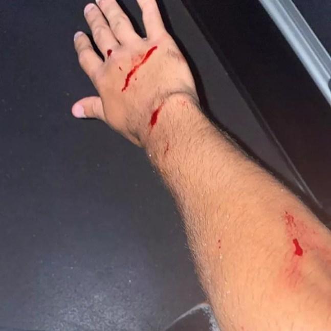Estilhaços cortaram o braço do meia Locatelli — Foto: Reprodução Redes Sociais