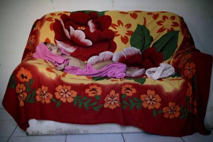 Luana Vieira, que tem dois anos de idade e nasceu com microcefalia, deitada no sofá após tomar banho, em casa, em Olinda — Foto: Ueslei Marcelino/Reuters