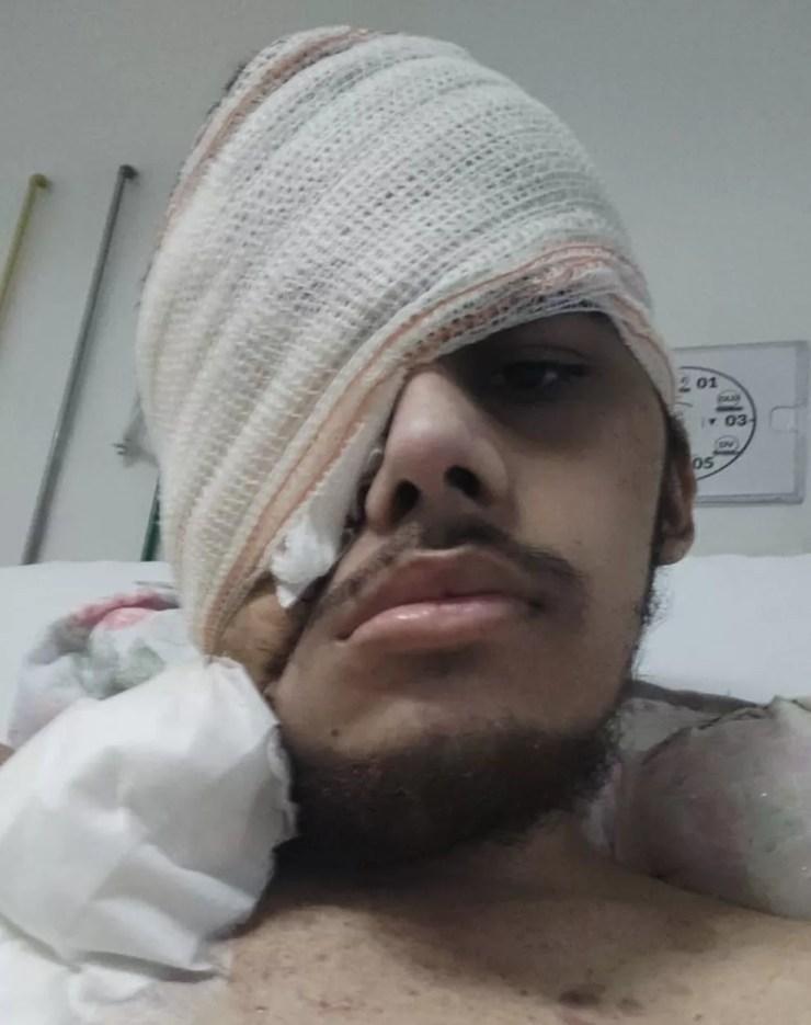 Jovem não desistiu de lutar, mesmo com os desafios vividos devido ao sarcoma que o fez perder um dos olhos — Foto: Arquivo Pessoal