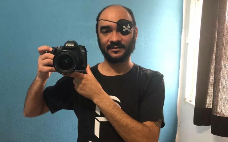 Sérgio Silva, fotógrafo que perdeu a visão do olho esquerdo após ser atingido por bala de borracha disparada pela PM em manifestação de 13 de junho de 2013 em São Paulo (Foto: Kleber Tomaz/G1)