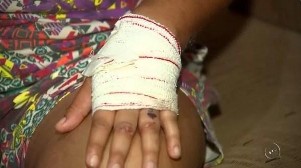 Mão de dona de acsa ficou ferida após agressão com serra elétrica em Mirassol (Foto: Reprodução/TV TEM)