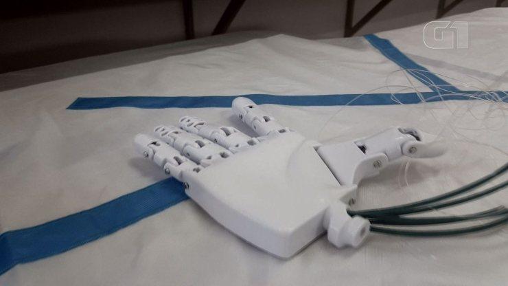Projeto de estudantes de Itajubá desenvolve prótese biônica 3D de baixo custo