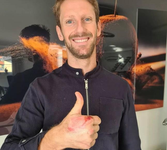 Romain Grosjean mostra a mão com queimadura após acidente no Barein — Foto: Reprodução/rede social