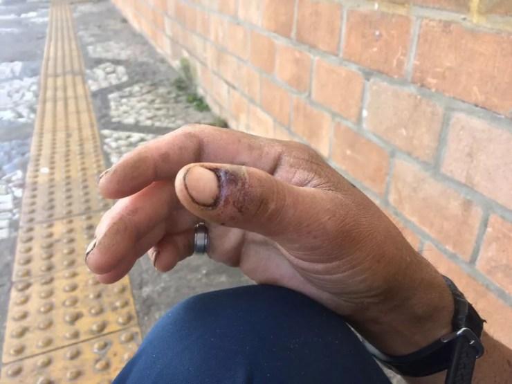 Carroceiro diz que policiais machucaram dedos dele (Foto: Paula Paiva/G1)
