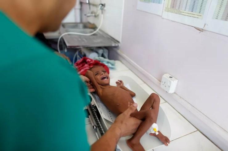 Criança sub-nutrida é atendida em hospital no Iêmen. — Foto: REUTERS/Khaled Abdullah