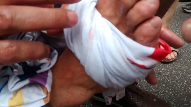 Manifestante fica ferido em manifestação em frente a Câmara dos Vereadores — Foto: Walace Lara/TV Globo