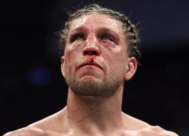 Brian Ortega teve o osso orbital direito fraturado na luta contra Alexander Volkanovski no UFC 266 — Foto: Getty Images