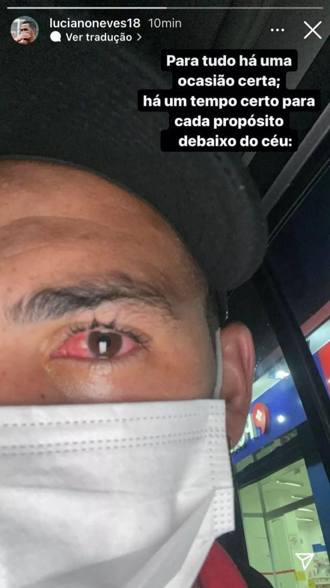 Desfalque do São Paulo, Luciano posta foto do olho — Foto: Reprodução