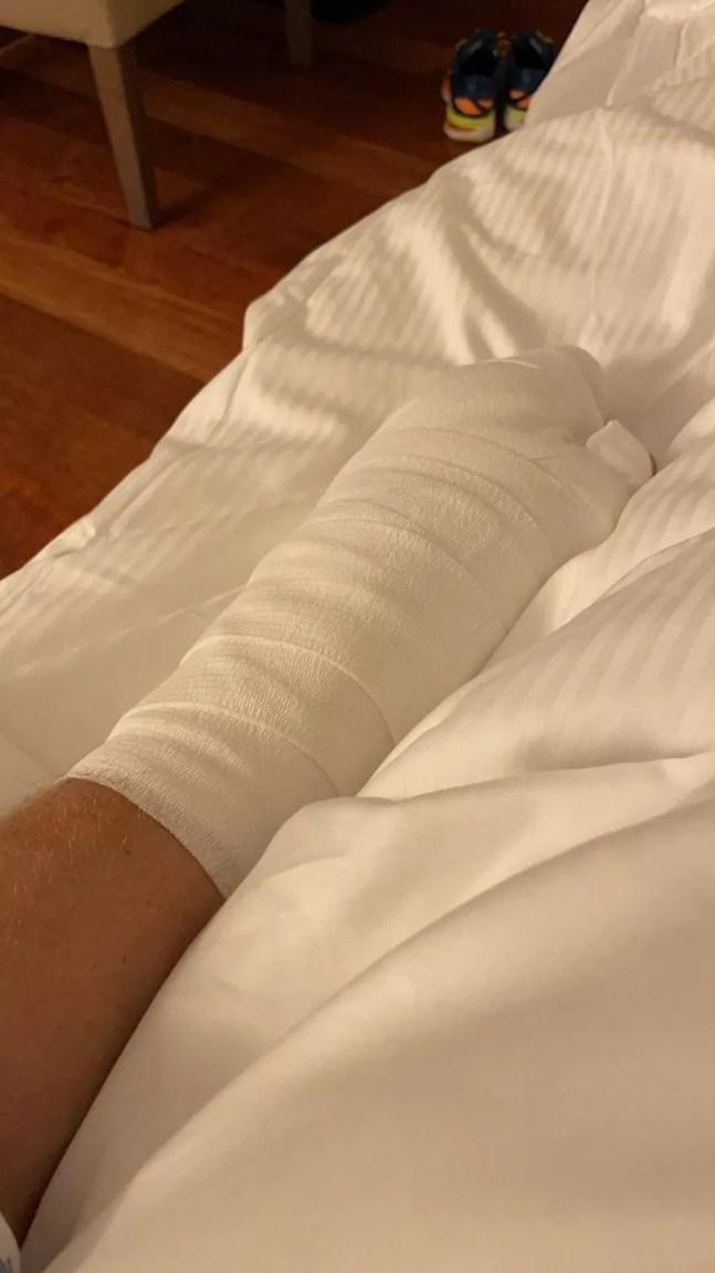 Romain Grosjean mostra mão enfaixada após transplante de pele — Foto: Reprodução/Twitter