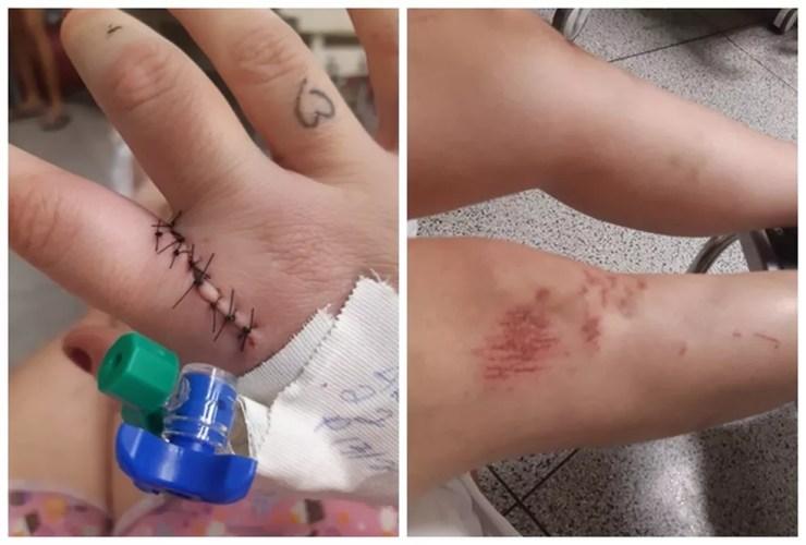 Mulher que foi amarrada em engate de carro e arrastada em estrada vicinal de Nipoã (SP) sofreu diversos ferimentos  — Foto: Arquivo pessoal 