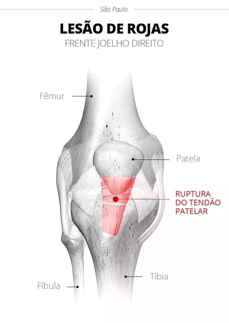Primeiro lesão de Rojas no joelho — Foto: Infoesporte