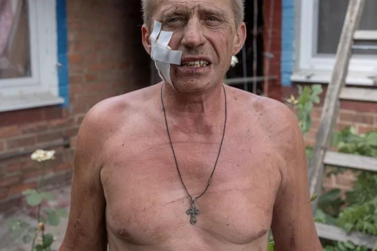 Yurii Sherbakov, 53, aparece ferido diante da própria casa em Sloviansk, Ucrânia — Foto: Marko Djurica/REUTERS