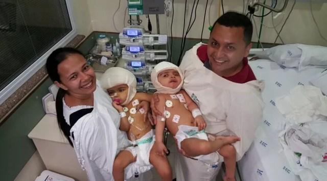 Pais com as gêmeas que nasceram unidas pela cabeça após cirurgia de separação em Ribeirão Preto — Foto: Divulgação/HC-RP