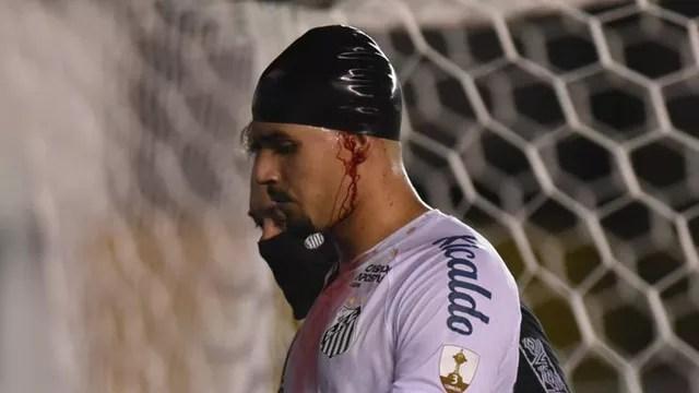 Lucas Veríssimo sangrando em Santos x Boca