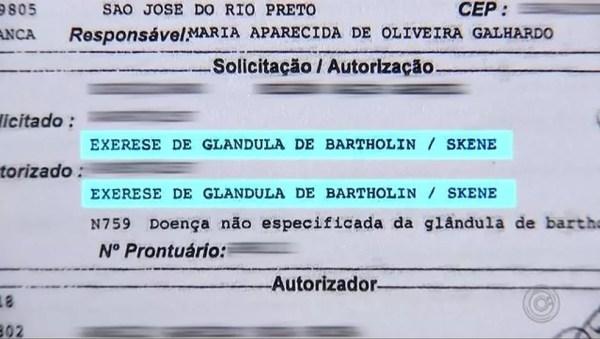 Solicitação da médica foi para retirada de uma glândula da paciente da Santa Casa de Rio Preto (SP) — Foto: Reprodução/TV TEM