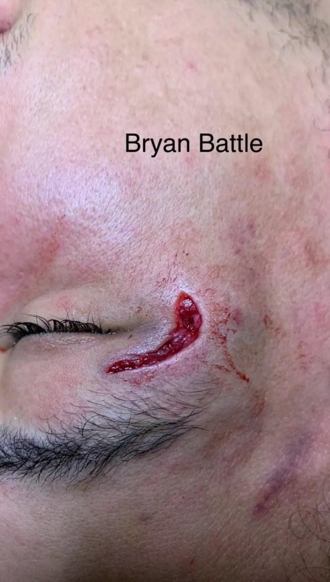 Bryan Battle após luta com Gilbert Urbina UFC — Foto: Reprodução / Instagram Dana White