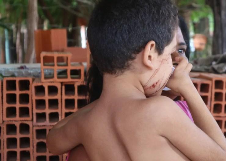 Menino de 4 anos ficou levemente ferido no desamento do quarto.  — Foto: Gilcilene Araújo/G1