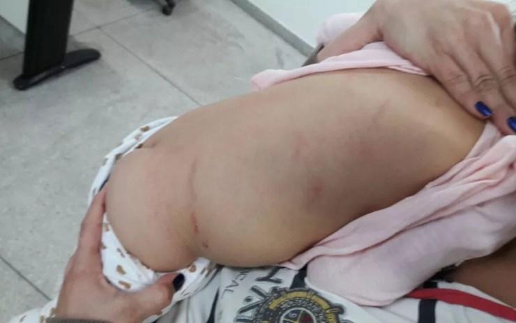 Criança teve outras lesões, mas madrasta diz que deu apenas um tapa no rosto da menina (Foto: Reprodução/TV Anhanguera)