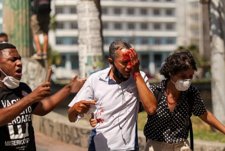 Daniel da Silva perdeu o olho após ser atingido por bala de borracha atirada pela PM em protesto contra Bolsonaro — Foto: Hugo Muniz