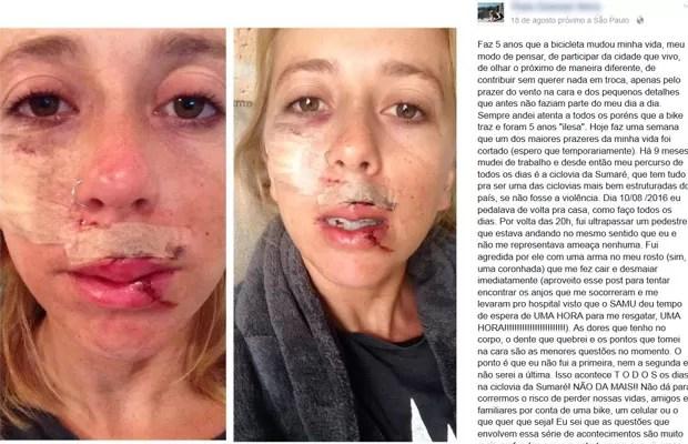 Jovem atacada postou foro do rosto machucado em sua página no Facebook  (Foto: Reprodução/Facebook)