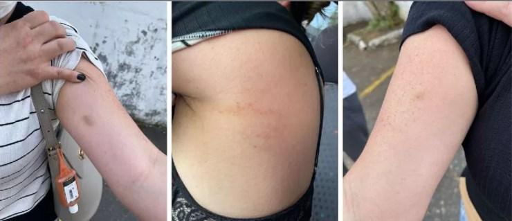 Mulher mostra marcas das agressões que sofreu do marido — Foto: Divulgação/Arquivo pessoal