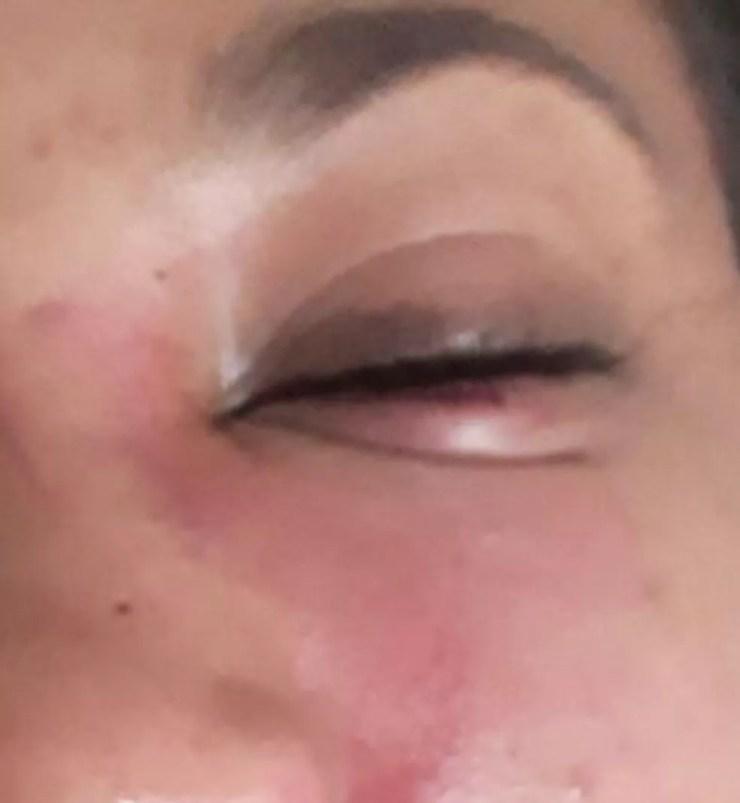 Jovem sofreu ferimentos principalmente no rosto durante as agressões (Foto: Arquivo pessoal )