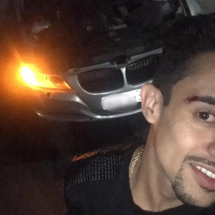 BMW atrás do dono, o motorista Luis Rochel, 24, que teve um corte no supercílio direito — Foto: Reprodução/Divulgação/Arquivo pessoal