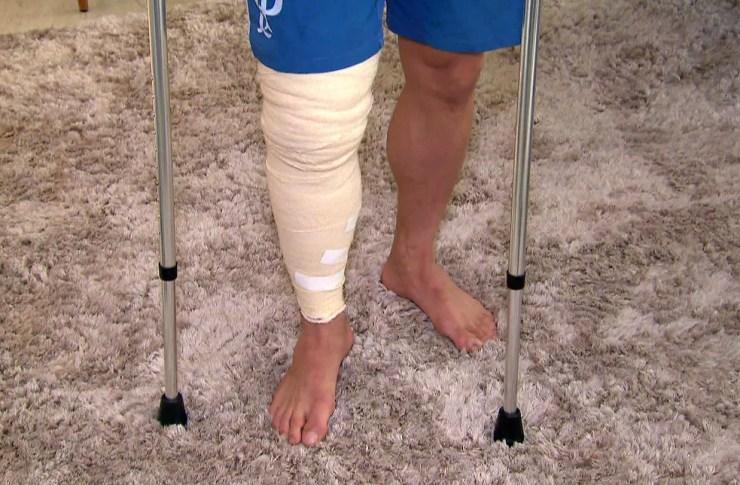Willian, atacante do Palmeiras, com a perna enfaixada — Foto: Reprodução/TV Globo