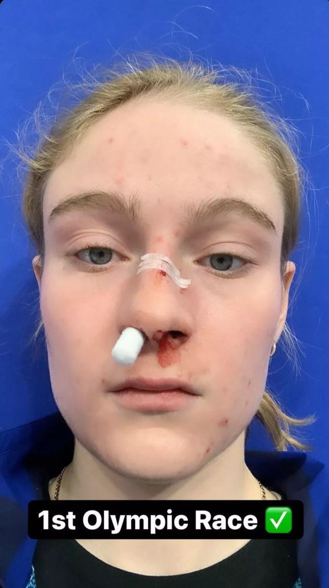 Corinne Stoddard quebrou o nariz durante disputa da patinação de velocidade — Foto: Reprodução