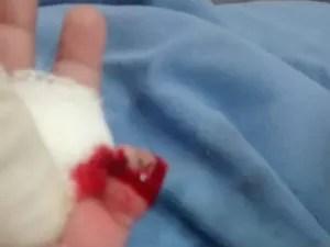 Bebê teve dedo cortado na segunda-feira (12) (Foto: Jaqueciane Moraes/Arquivo pessoal)