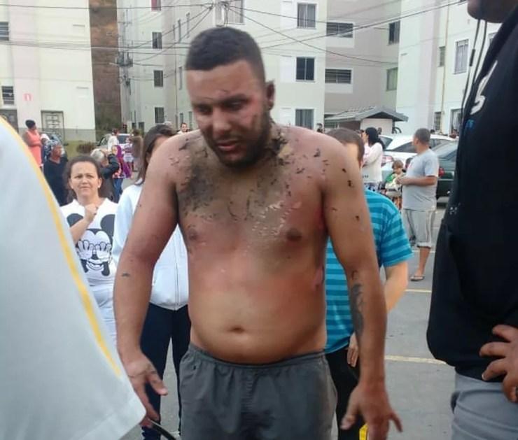 Jefferson Quintanilha teve 60% do corpo queimados e está em estado grave (Foto: Polícia Militar | Divulgação)