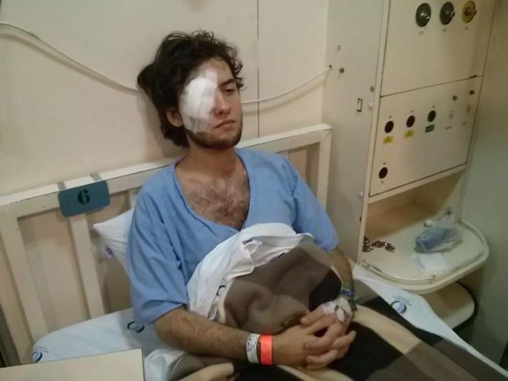 Manifestante Vitor Araújo em foto tirada pelo GAPP em 8 de setembro de 2013: um dia antes ele foi atingido por estilhaço de bomba da PM de SP e ficou cego durante protesto (Foto: Divulgação/GAPP)