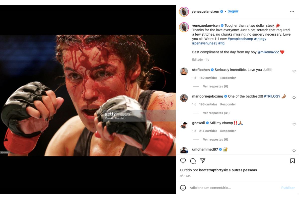 UFC: rostos de Amanda e Peña ficam deformados após luta e viralizam nas redes; veja as imagens